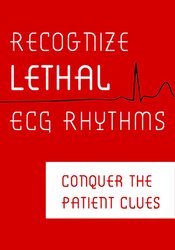 Robin Gilbert – Recognize Lethal ECG Rhythms – Conquer the Patient Clues